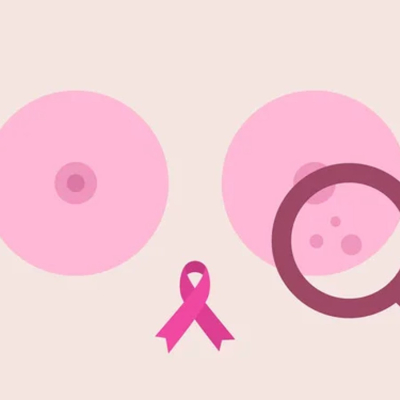 Proposta de rastreio do cancro da mama alargado a mais faixas etárias
